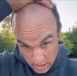 太陽報：前美國國腳多諾萬為脫發(fā)苦惱，向粉絲求助幫忙挑假發(fā)